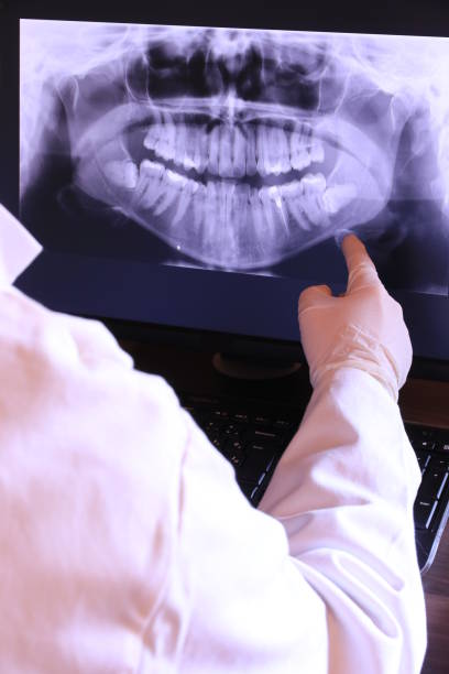 Best Urgent Care for Lost Fillings or Crowns in Fort Pierre, SD